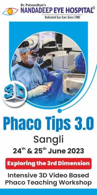 Phaco Tips 3.0