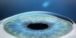 Project Navdrushti  ( Free Corneal transplant)
